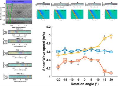 Detection of natural pulse waves (PWs) in 3D using high frame rate imaging for anisotropy characterization